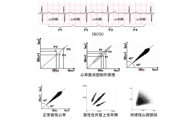 体征监测原理中的心冲击图和心率变异性怎么看？