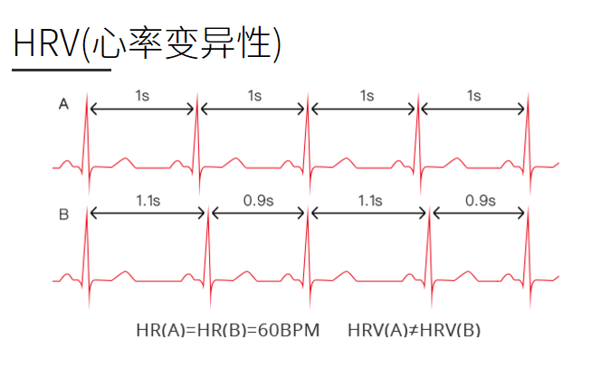 体征监测原理之BCG Vs HRV(图2)