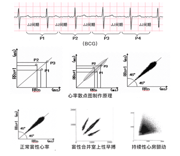 体征监测原理之BCG Vs HRV(图4)